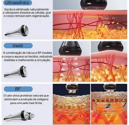 Aparelho de lipo CAVITAÇÃO.